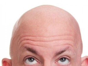 Find The Right Baldness Treatment In The Sydney CBD